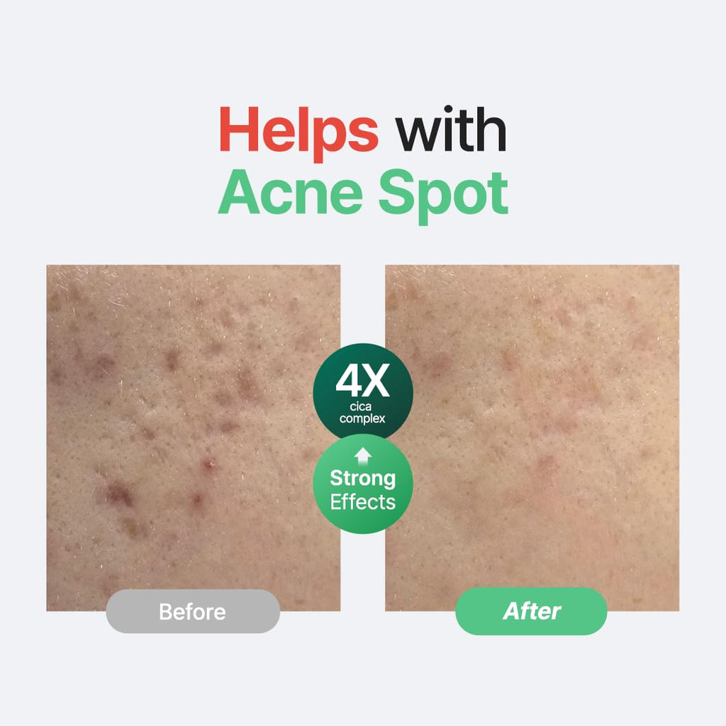 Purito Wonder Releaf Centella Serum Unscented 60ml