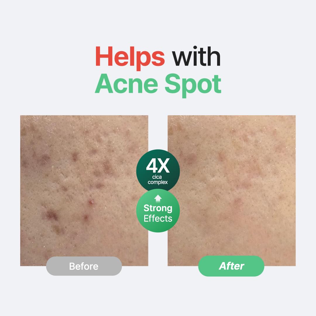 Purito Wonder Releaf Centella Serum Unscented 60ml