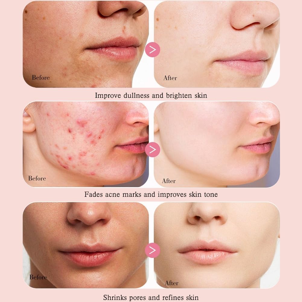 Anua Peach 70 Niacin Serum 30ml