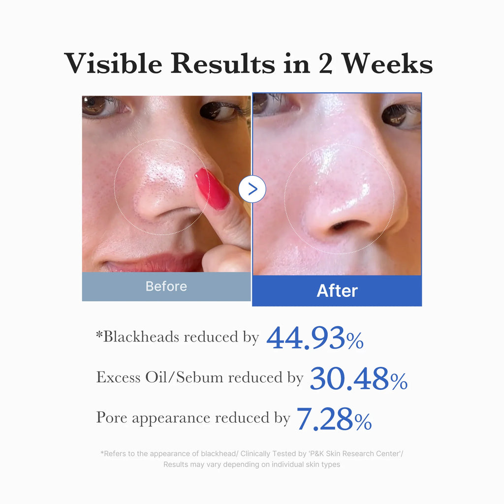 Medicube Zero Pore Pad 2.0 (70pads)